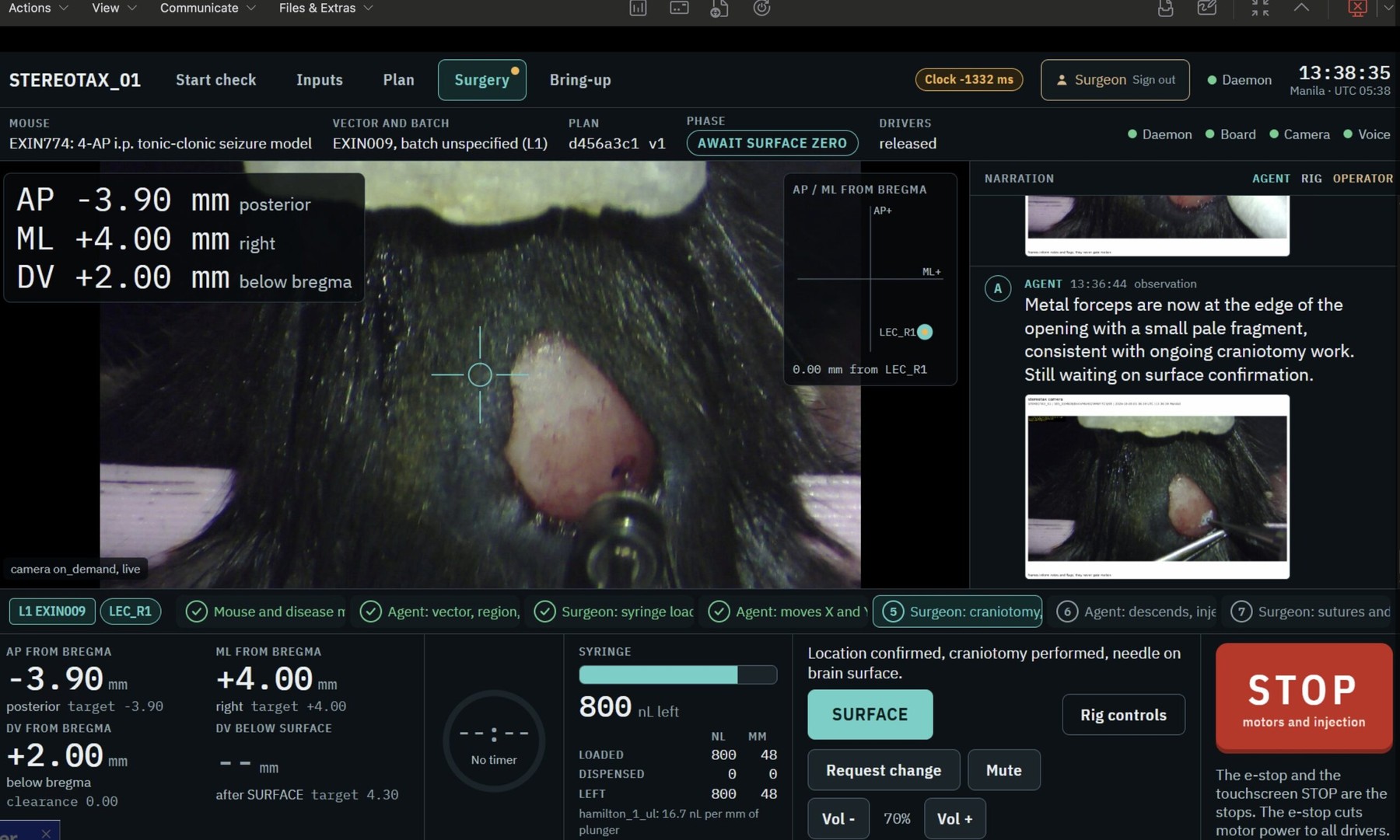 The control interface during surgery. The left panel shows the live camera feed with target coordinates, while the right panel displays the AI agent's observations and the emergency stop button. | Image: Gabriel Ocana-Santero via X