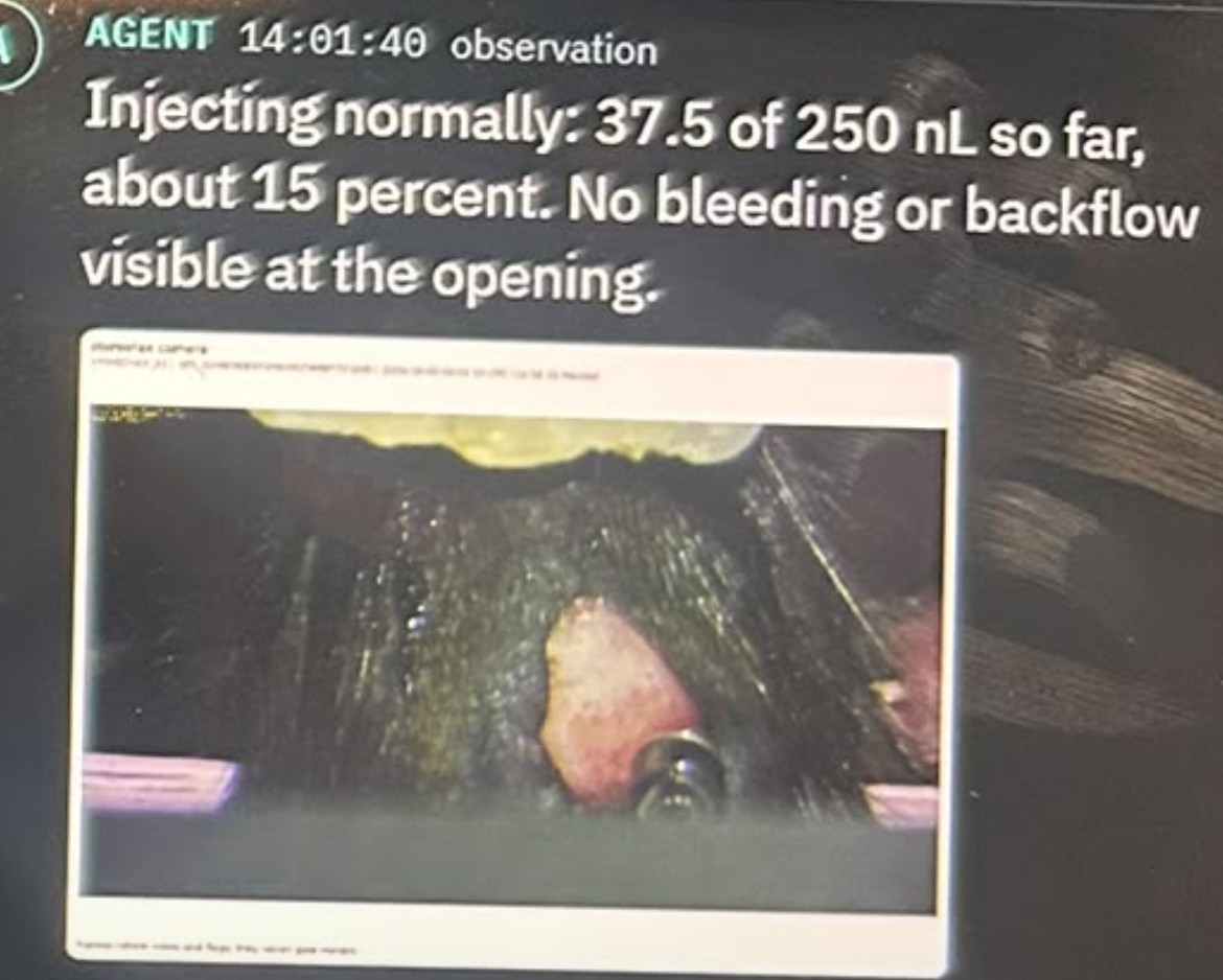 The AI agent watches the injection through a camera and reports that 15 percent has been injected, with no visible bleeding or backflow. | Image: Gabriel Ocana-Santero via X